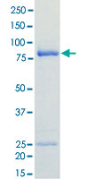 Loading 1 μg protein in SDS-PAGE